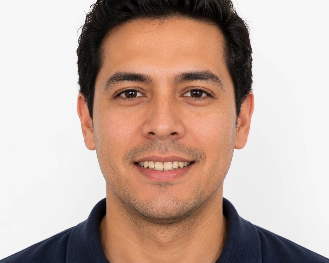 Dientes antes del blanqueamiento dental profesional en Salamanca, Guanajuato