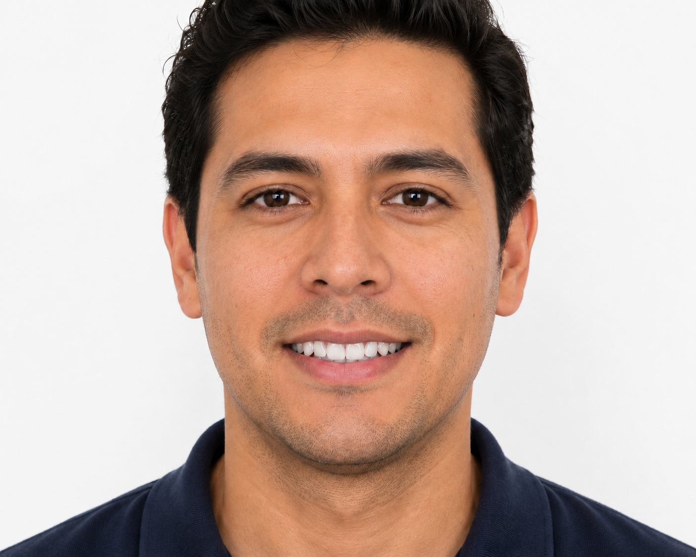 Dientes varios tonos más blancos después del blanqueamiento dental en Salamanca